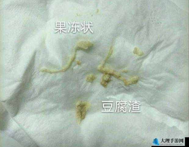 女生次数多了是否会有豆腐渣分泌物